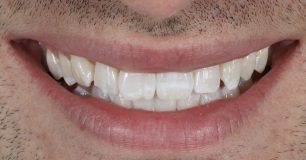 Before - Ringway Dental