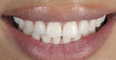 Before - Ringway Dental