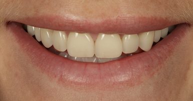 Before - Ringway Dental